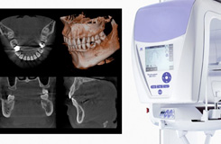 歯科用３次元CT