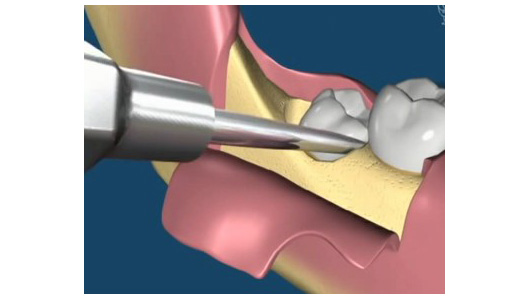 札幌東区　歯科口腔外科