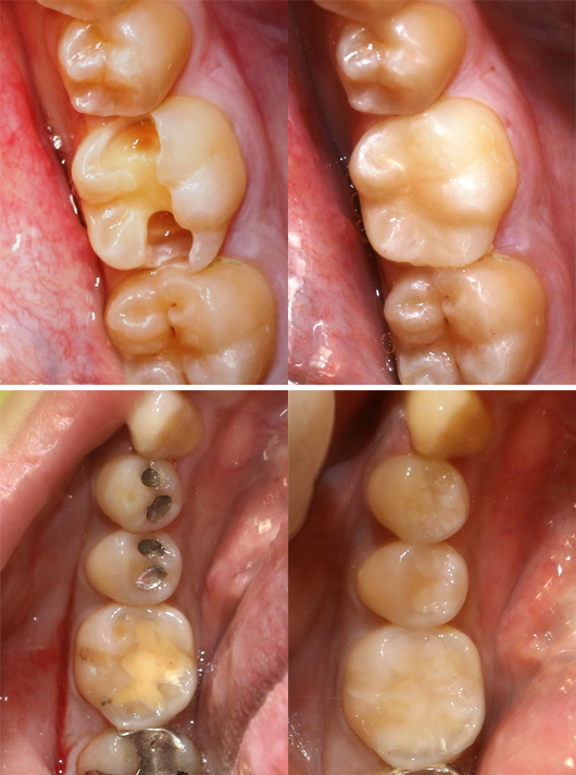 札幌東区　一般歯科