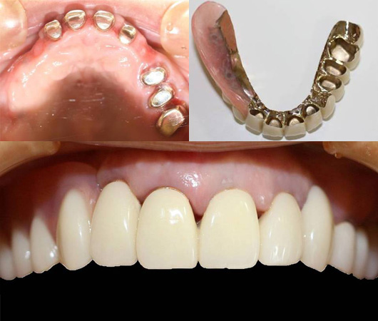 札幌東区　コーヌスデンチャー